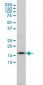 SSR4 Antibody (monoclonal) (M01)